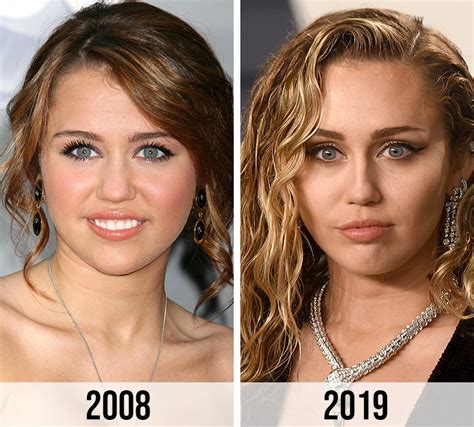 miley cyrus before and after plastic surgery|More.